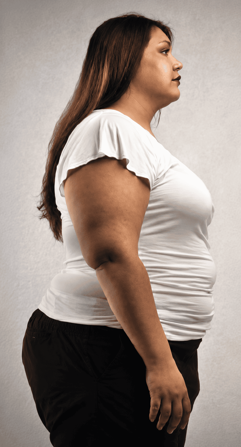 খাওয়ার আগে - Weight Loss Journey Before